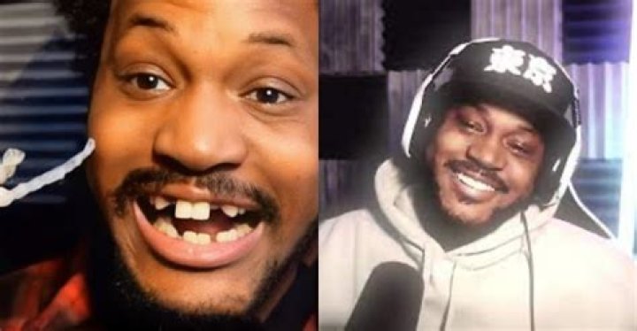 CoryxKenshin Teeth