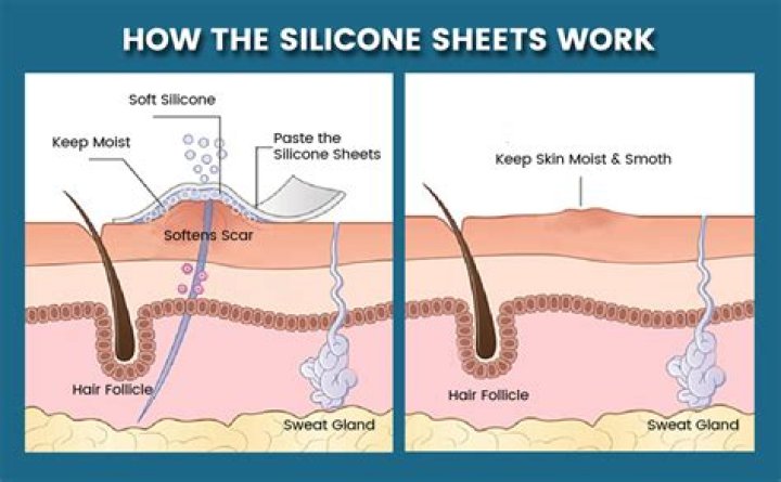 When should you start using silicone sheets?